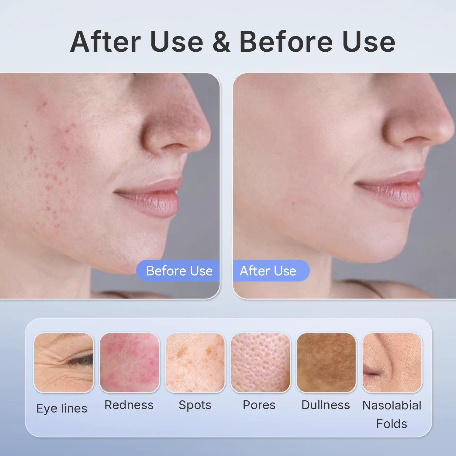 Hello Face 510K Wireless Near-Infrared and Red Light Therapy Facial Mask For Powerful Anti-ageing Professional Ultra-light Mask
