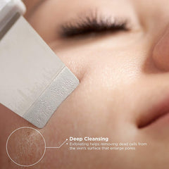 Beauty Star Ultrasonic Face Cleaning  Skin Scrubber